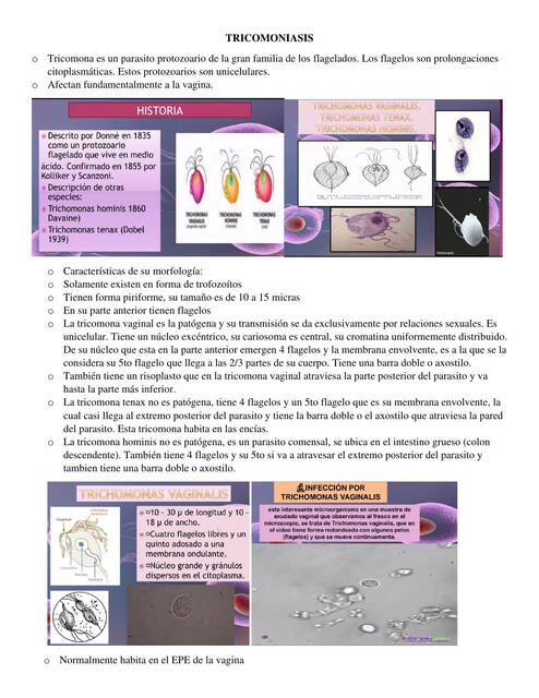 Tricomoniasis