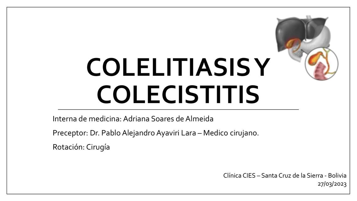 Colelitiasis Y Colecistitis | Adriana S Almeida | UDocz