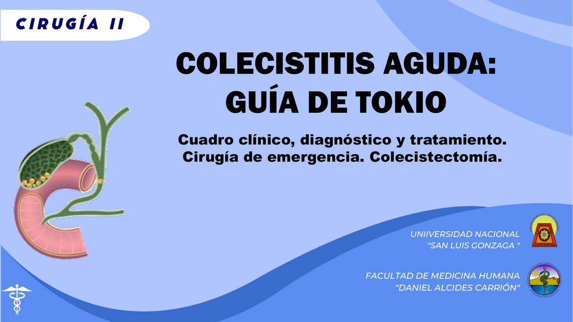 Colecistitis Aguda 