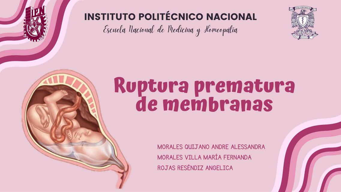 Ruptura Prematura de membranas