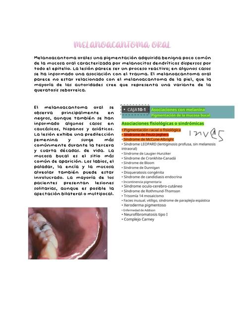 Melanoacantoma oral