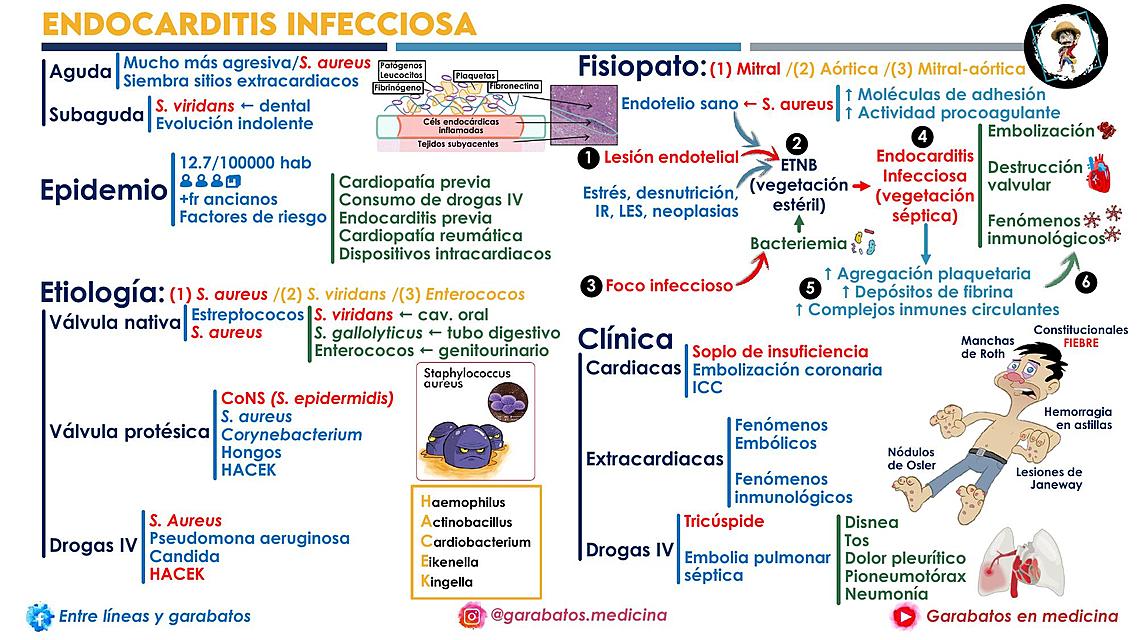 Endocarditis infecciosa: en la palma de tus manos