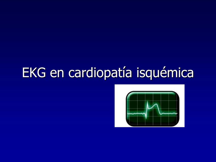 EKG en Cardiopatía Isquémica 