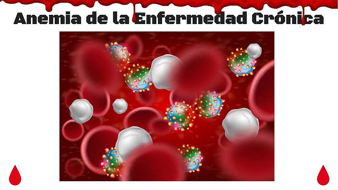 Anemia Enf Crónica Y Anemia Aplasica (Robbins) | Anemia Aplásica ...