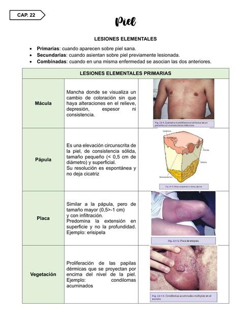 Piel - Lesiones Elementales 