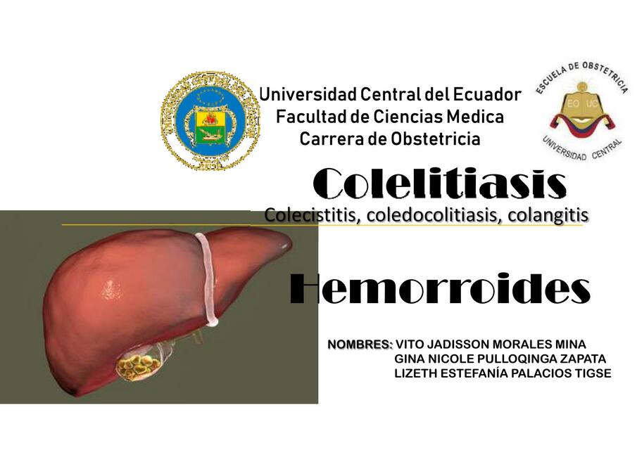 Colelitiasis, Colecistitis, Coledocolitiasis, Colangitis | Vito Morales ...