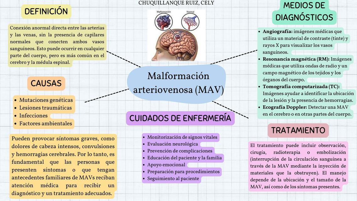 Malformación Arteriovenosa 