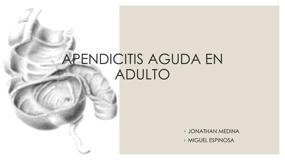 Apendicitis aguda en adulto