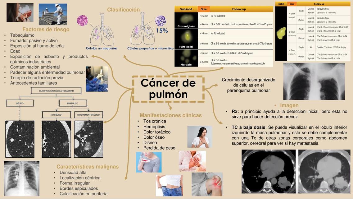 Cáncer de pulmón 