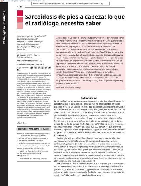 Sarcoidosis  