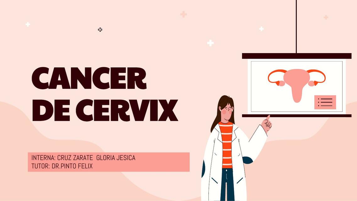 Cáncer de Cérvix 