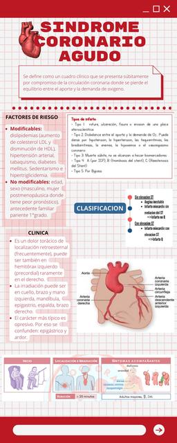 Síndrome coronario agudo   