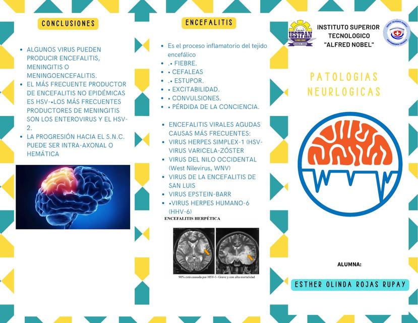 Patologías Neurológicas 