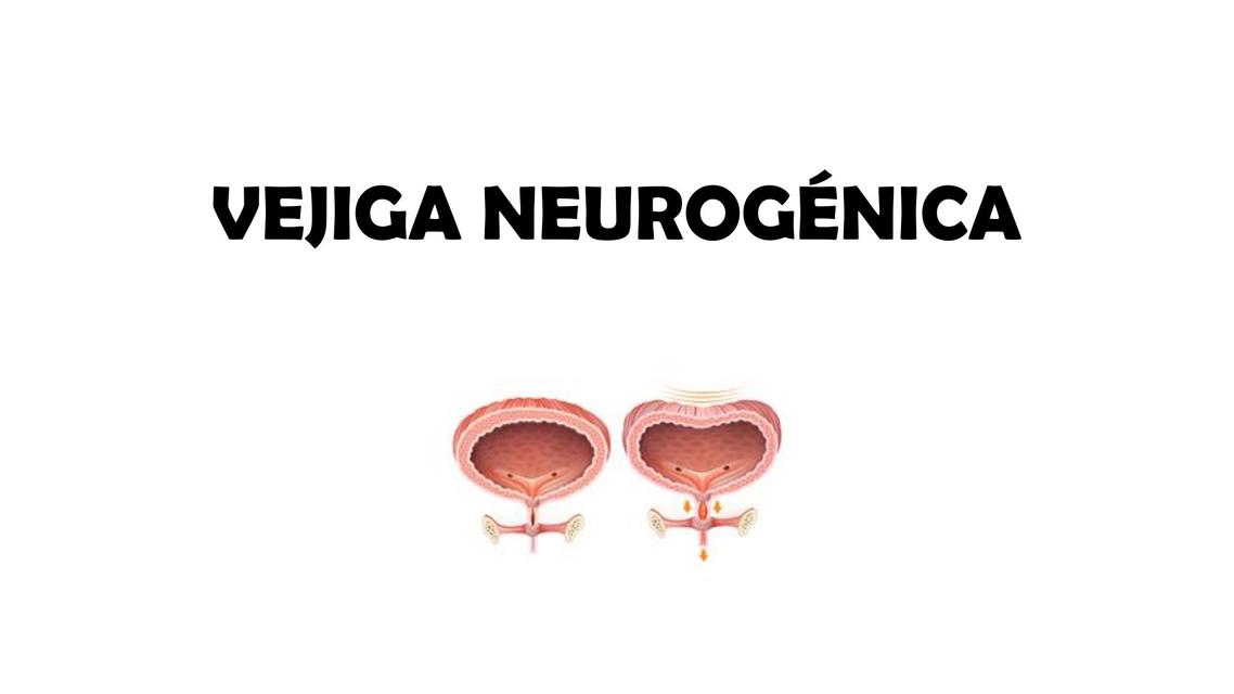 Vejiga Neurogénica   