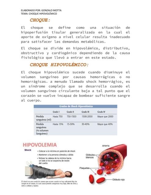 Flashcards de CHOQUE HIPOVOLÉMICO / SHOCK HIPOVOLÉMICO | Por Gonza ...