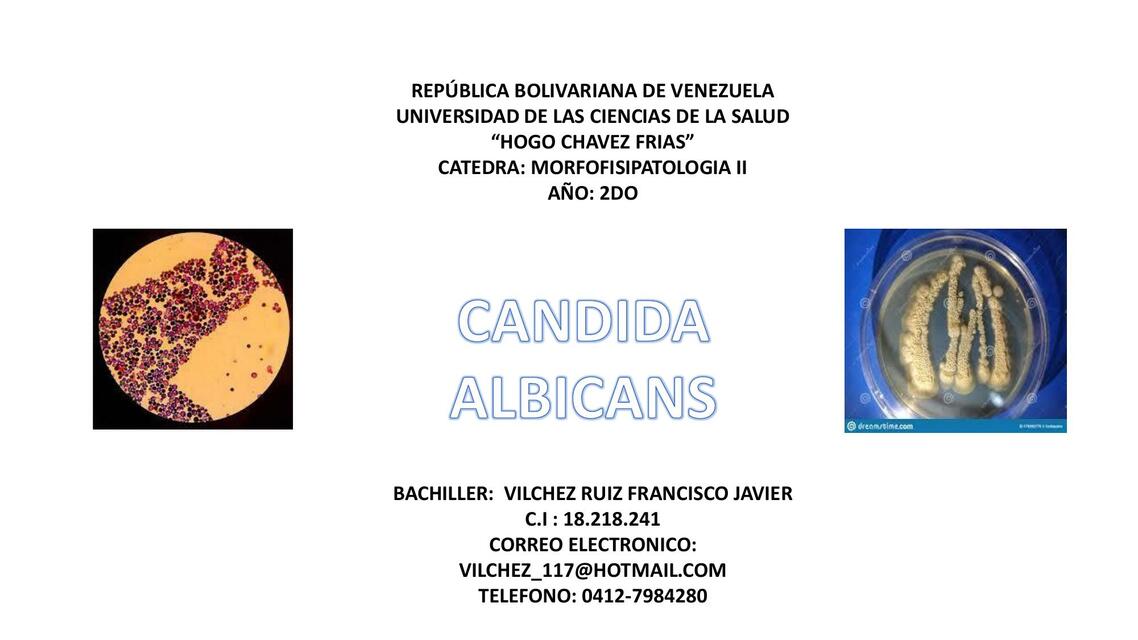 Cándida Albicans Francisco Javier Udocz Cándida Albicans Francisco Javier Udocz