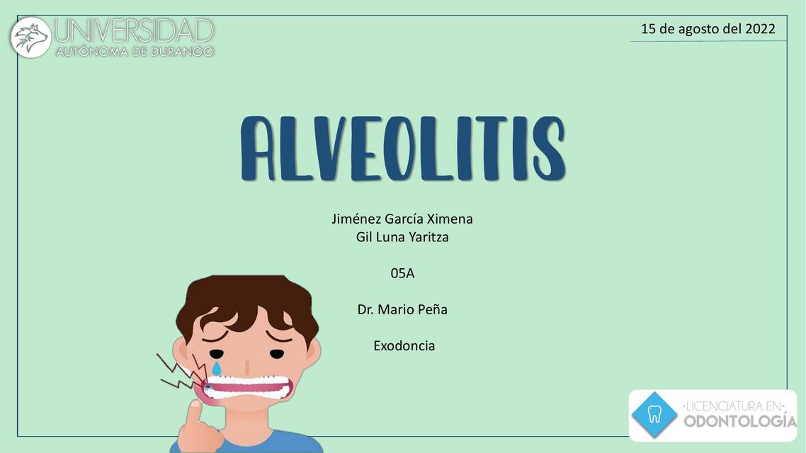 Alveolitis