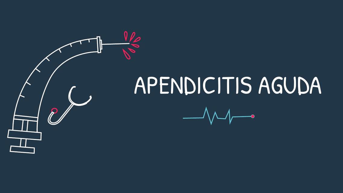 Apendicitis  aguda 