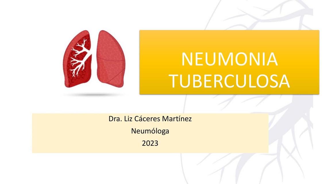 Neumonía Tuberculosa 