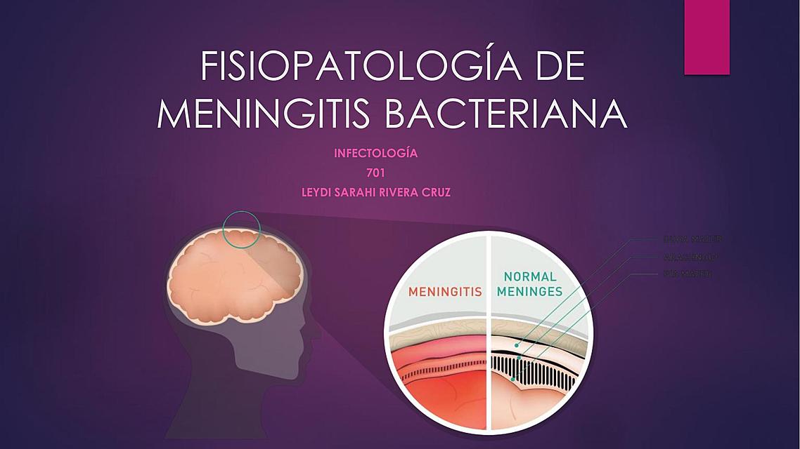 FISIOPATOLOGÍA DE MENINGITIS BACTERIANA