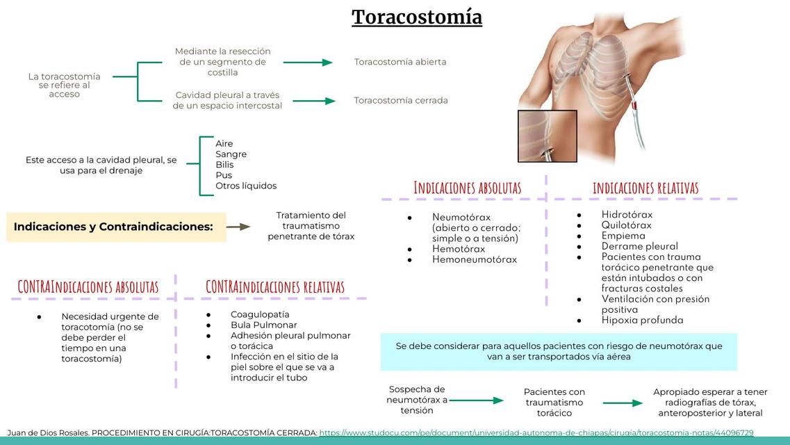 Toracotomía 