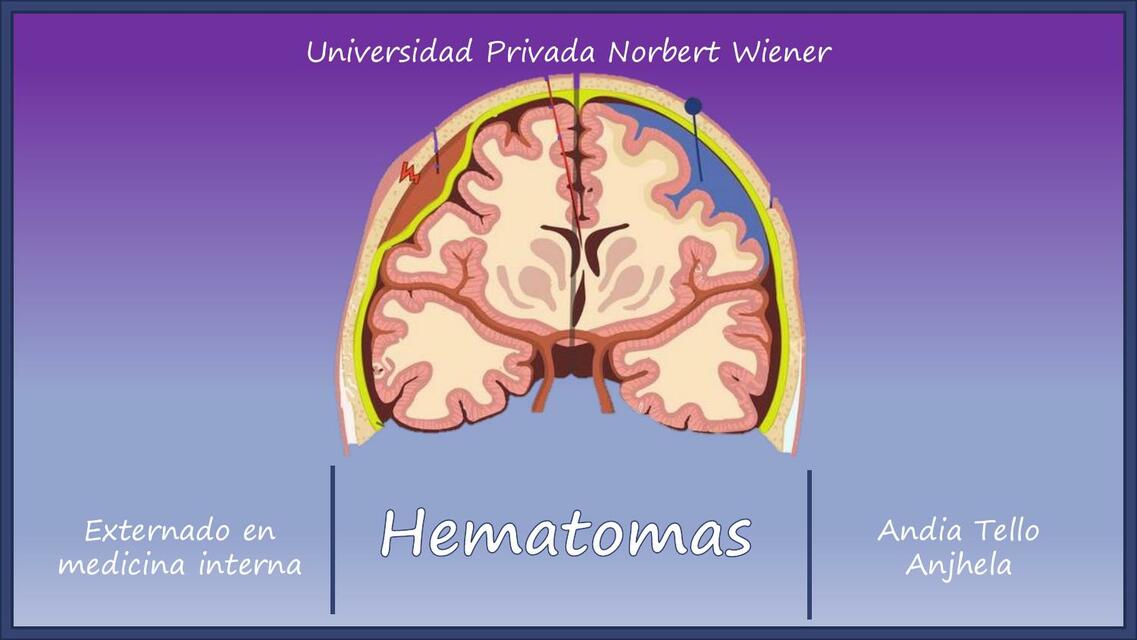 Hematomas