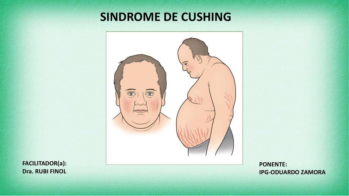 Síndrome de Cushing  