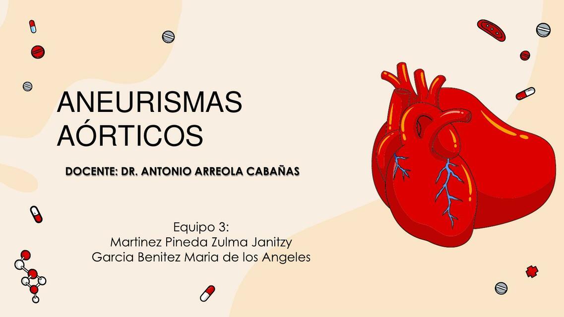 Aneurismas Aórticos | Estefanny Nuñez | uDocz