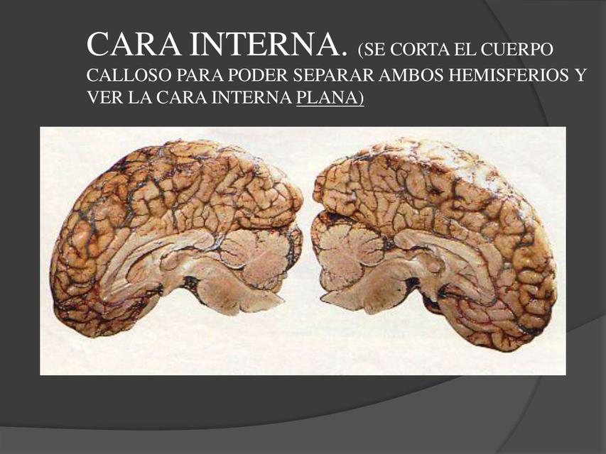 Cerebro 2 