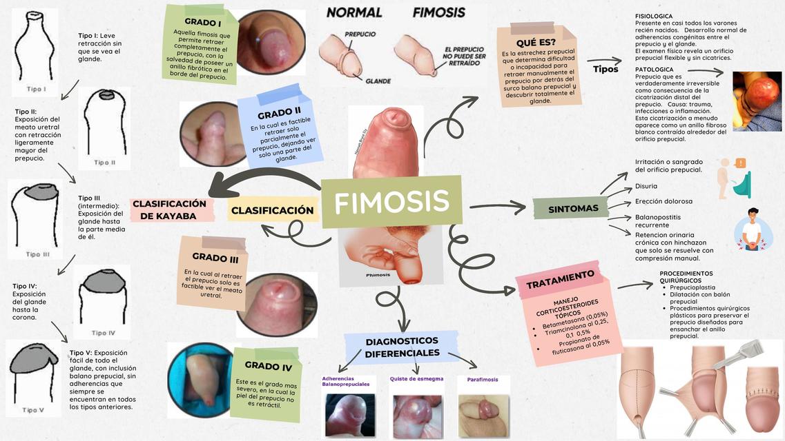 Fimosis  