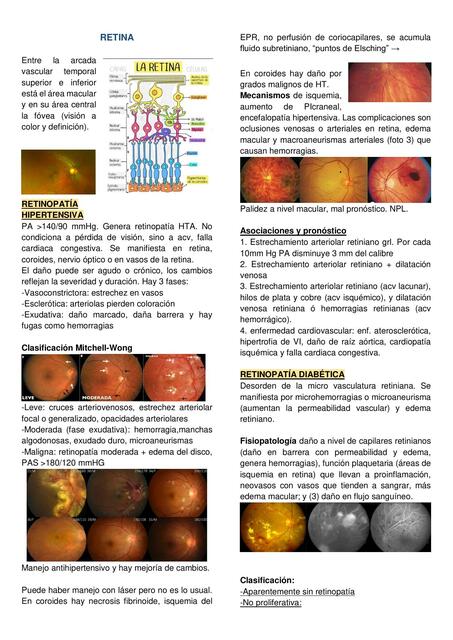 Patología  De Retina 