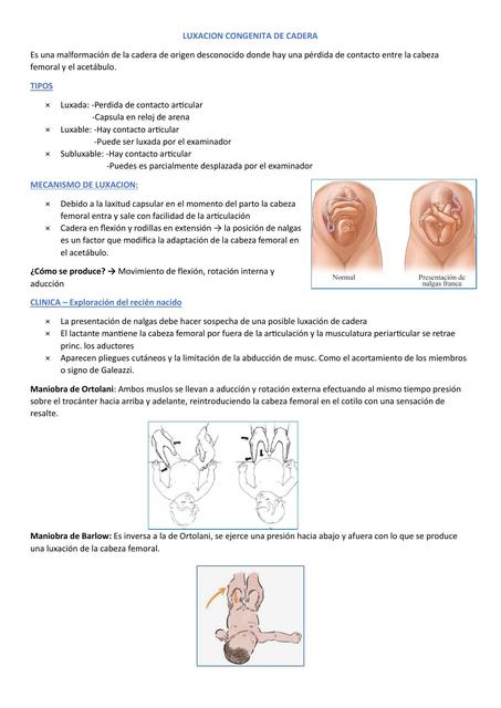 Luxación congénita de cadera 