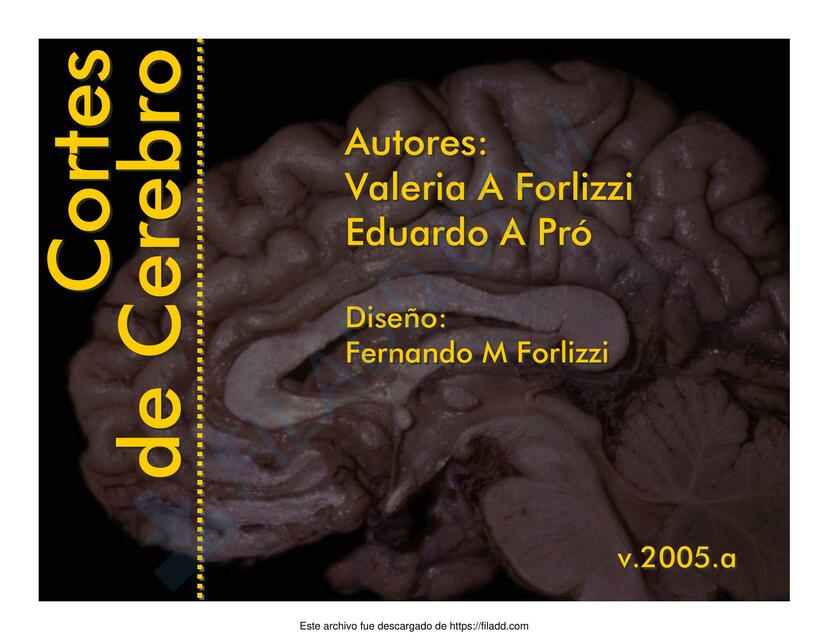 Cortes de cerebro 