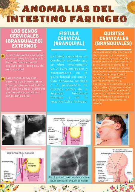 Anomalías del sistema digestivo