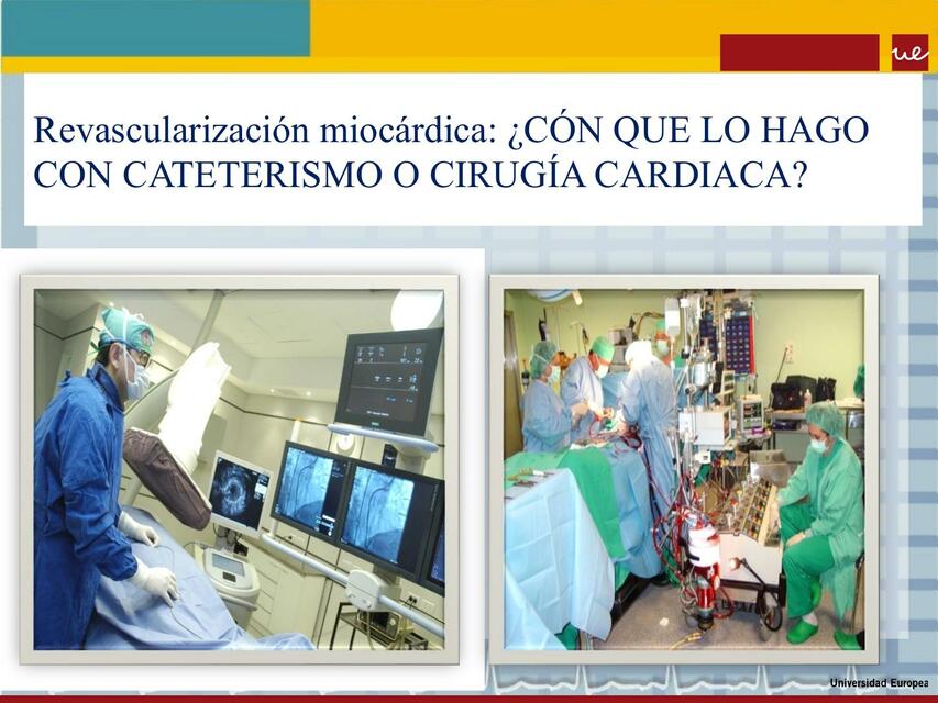 Revascularización Miocárdica 