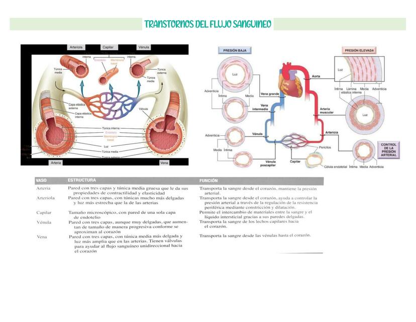 Trastornos del Flujo Sanguíneo