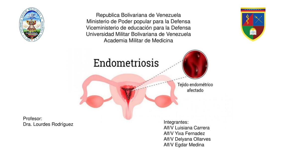 Endometriosis 