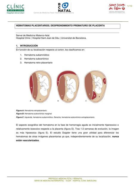 Hematoma placentario