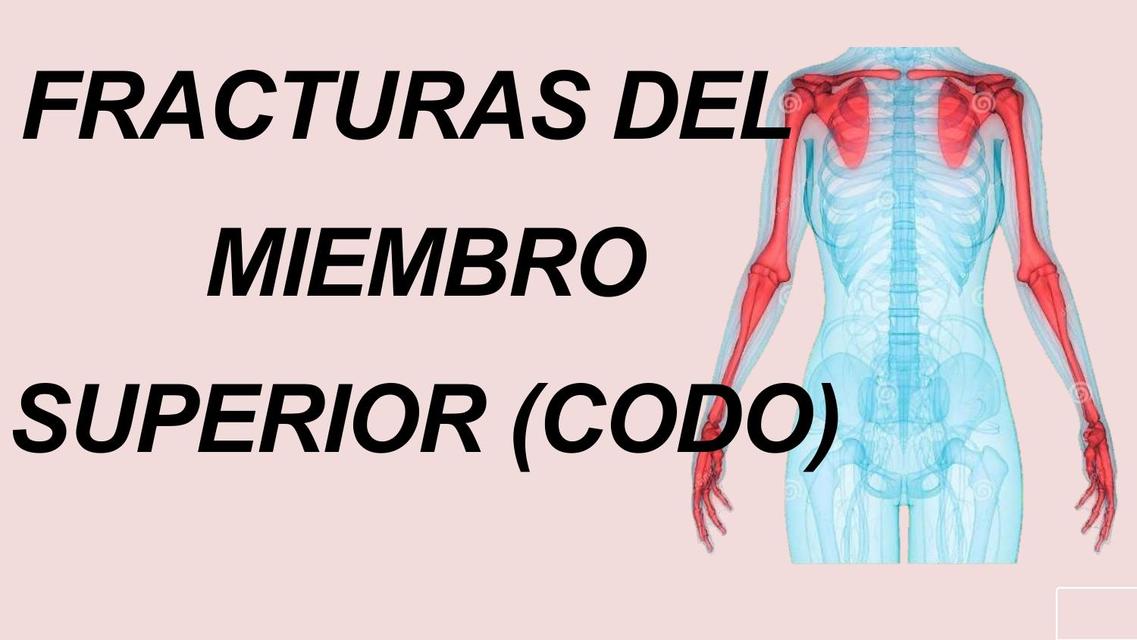 Fractura de codo 