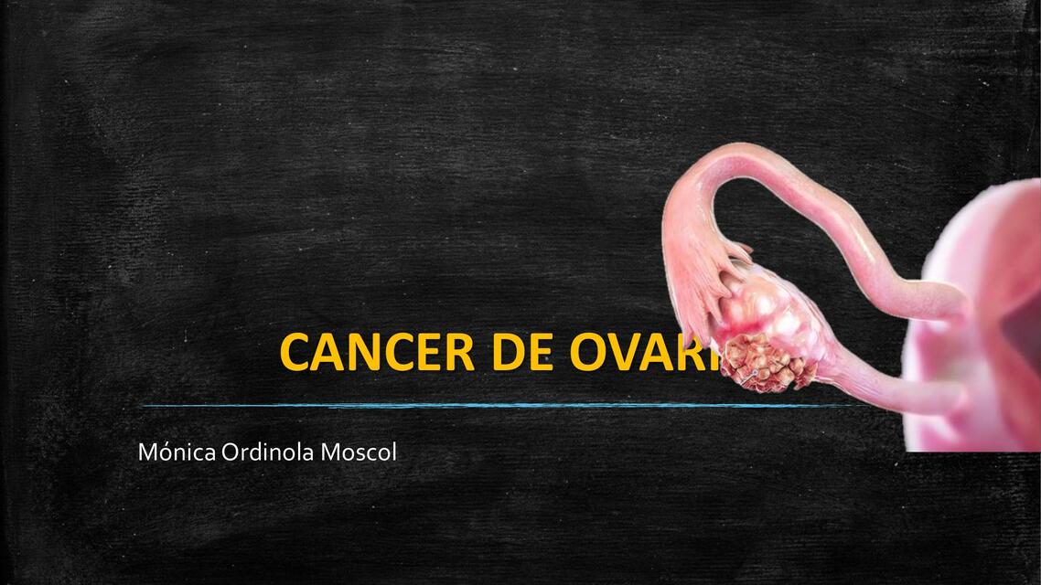 Cáncer de Ovario 