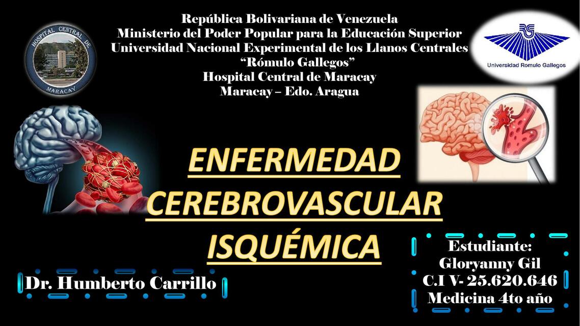 Enfermedad cerebrovascular isquémica 