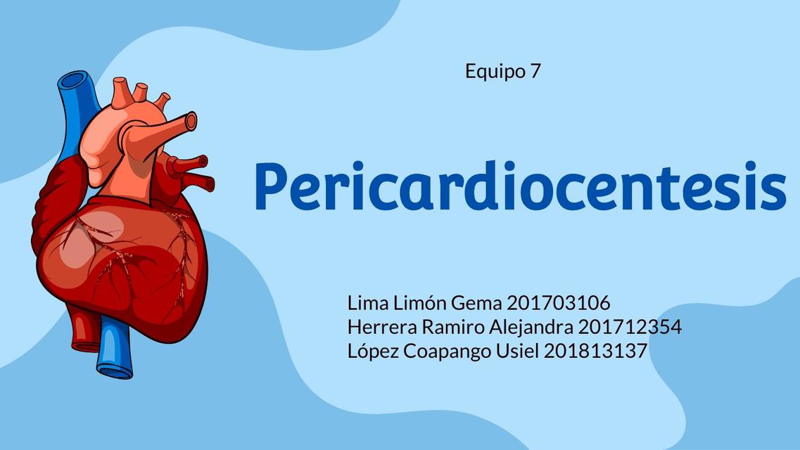 Pericardiocentesis 