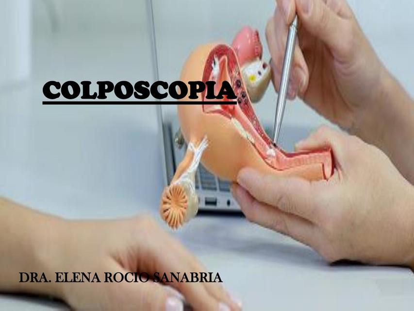 Colposcopia 