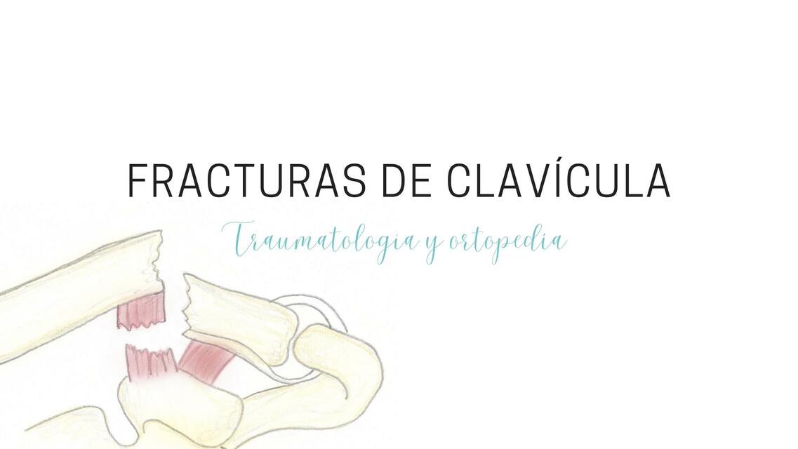 Fracturas de Clavícula y Húmero Proximal 