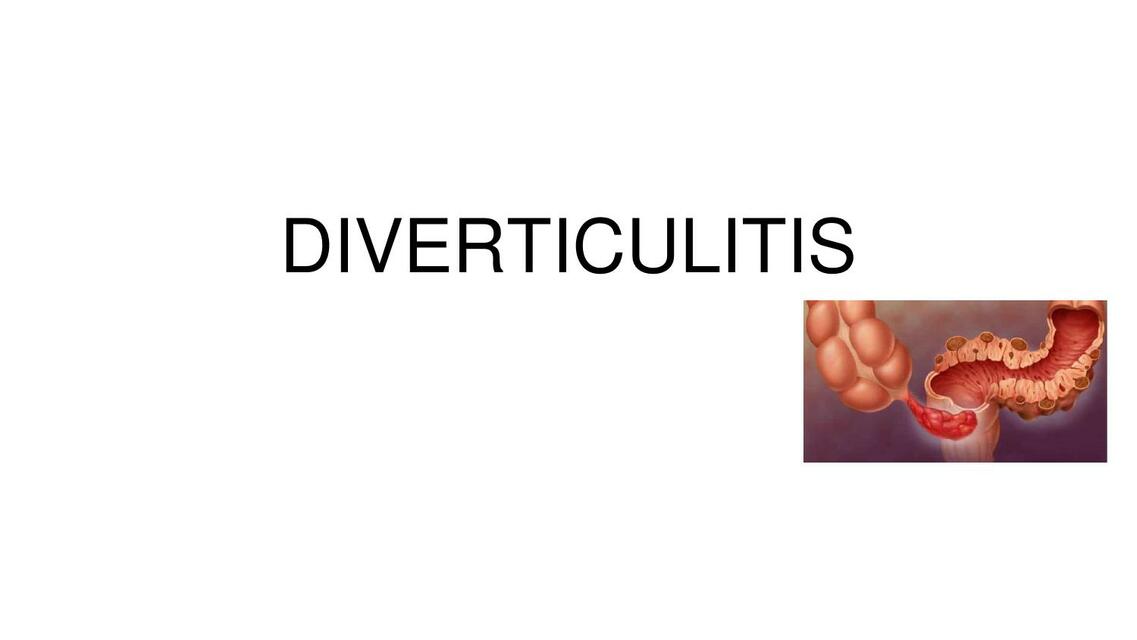 Diverticulitis Cirugía General MiddleMedic uDocz