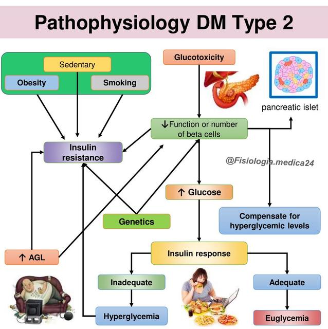 Pathophysiology of Type 2 Diabetes Mellitus | FISIOLOGÍA MÉDICA | uDocz