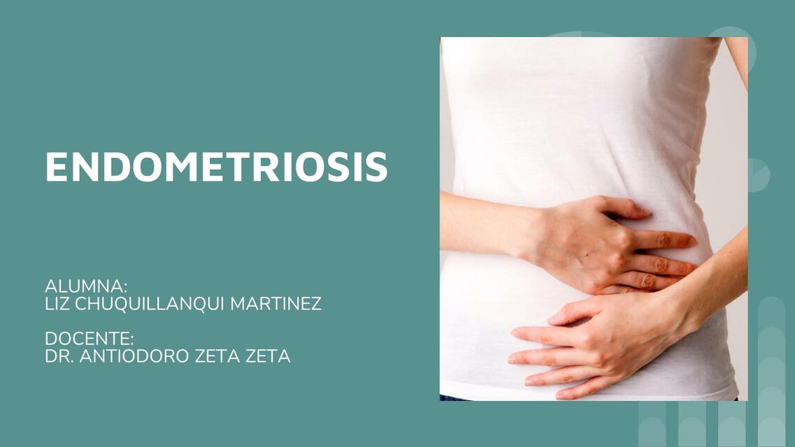 Endometriosis 