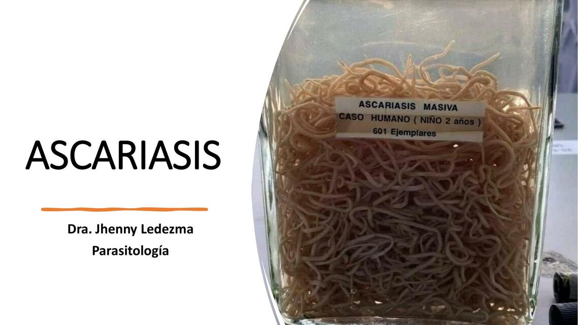 Ascariasis