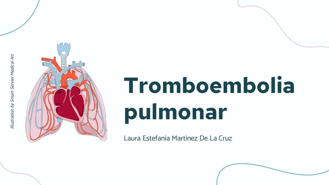 Tromboembolia pulmonar