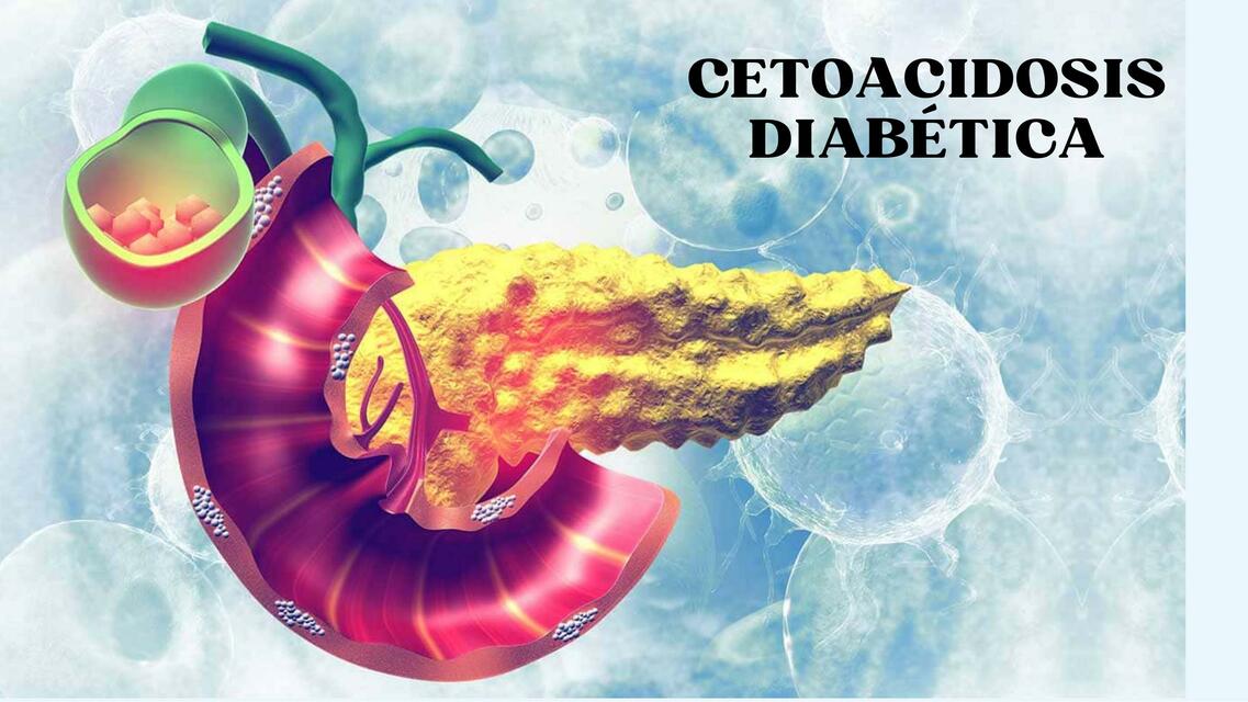 Cetoacidosis Diabética 